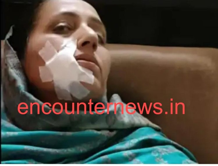 पंजाब : चाइना डोर की चपेट में आई महिला, लगे 10 टांके
